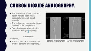 CARBON DIOXIDE ANGIOGRAPHY.
• The limitations of this contrast
agent include poor detail,
especially for small distal
vessels.
• The bolus may cause significant
discomfort for the patient.
• Complications-carbon dioxide
embolus, with gas trapping
mesenteric
ischemia,
• Carbon dioxide is not used for
arch or cerebral arteriography.
 