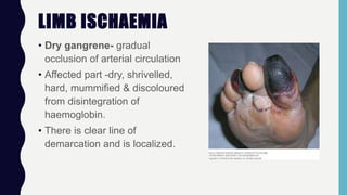 LIMB ISCHAEMIA
• Dry gangrene- gradual
occlusion of arterial circulation
• Affected part -dry, shrivelled,
hard, mummified & discoloured
from disintegration of
haemoglobin.
• There is clear line of
demarcation and is localized.
 