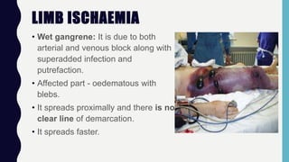 LIMB ISCHAEMIA
• Wet gangrene: It is due to both
arterial and venous block along with
superadded infection and
putrefaction.
• Affected part - oedematous with
blebs.
• It spreads proximally and there is no
clear line of demarcation.
• It spreads faster.
 