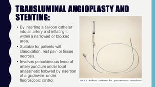 TRANSLUMINAL ANGIOPLASTY AND
STENTING:
• By inserting a balloon catheter
into an artery and inflating it
within a narrowed or blocked
area.
• Suitable for patients with
claudication, rest pain or tissue
necrosis.
• Involves percutaneous femoral
artery puncture under local
anaesthetic followed by insertion
of a guidewire under
fluoroscopic control.
 