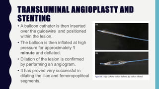 TRANSLUMINAL ANGIOPLASTY AND
STENTING
• A balloon catheter is then inserted
over the guidewire and positioned
within the lesion.
• The balloon is then inflated at high
pressure for approximately 1
minute and deflated.
• Dilation of the lesion is confirmed
by performing an angiogram.
• It has proved very successful in
dilating the iliac and femoropopliteal
segments.
 