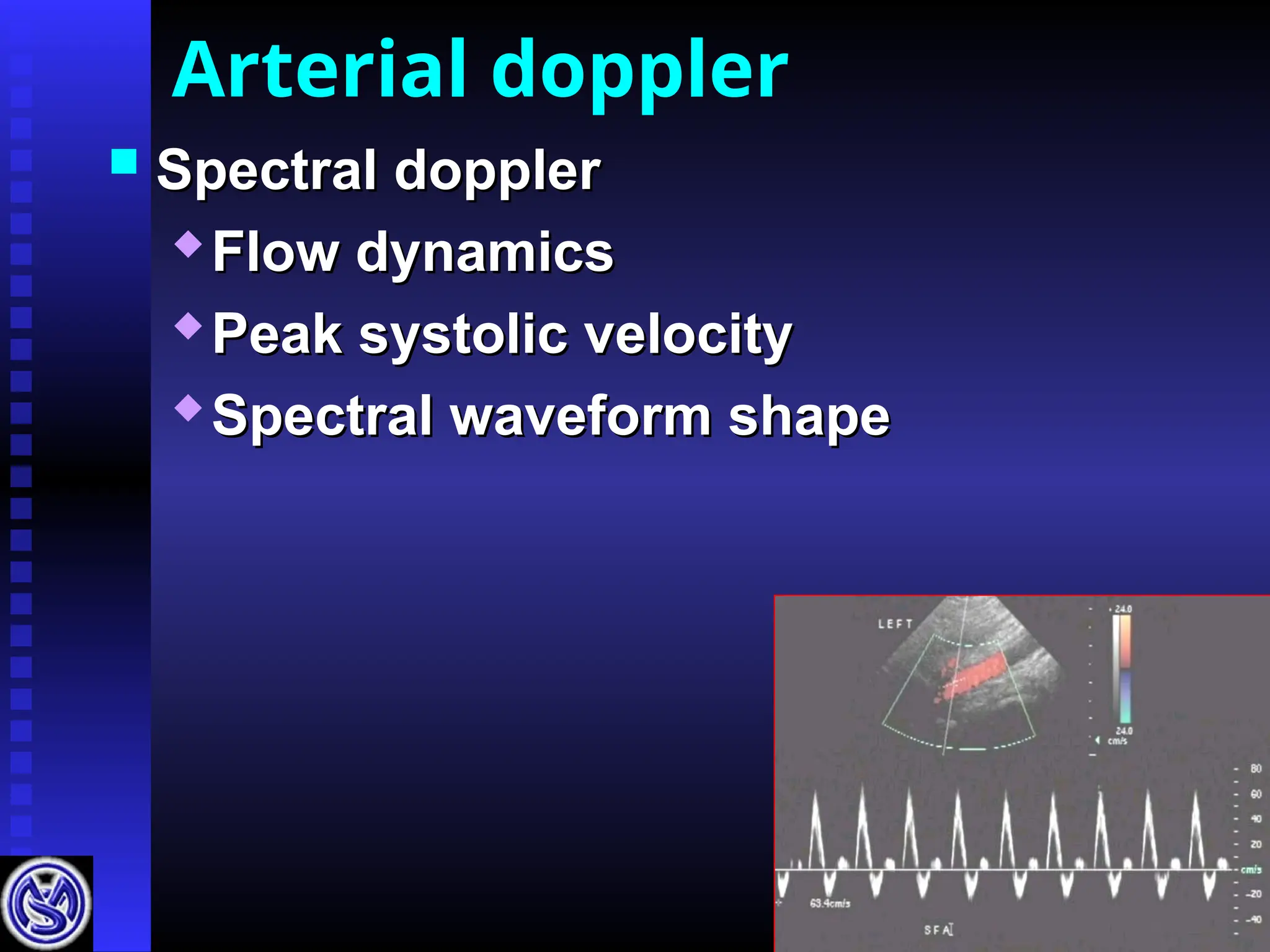 Arterial doppler
 Spectral doppler
Spectral doppler

Flow dynamics
Flow dynamics

Peak systolic velocity
Peak systolic velocity
 Spectral waveform shape
Spectral waveform shape
 