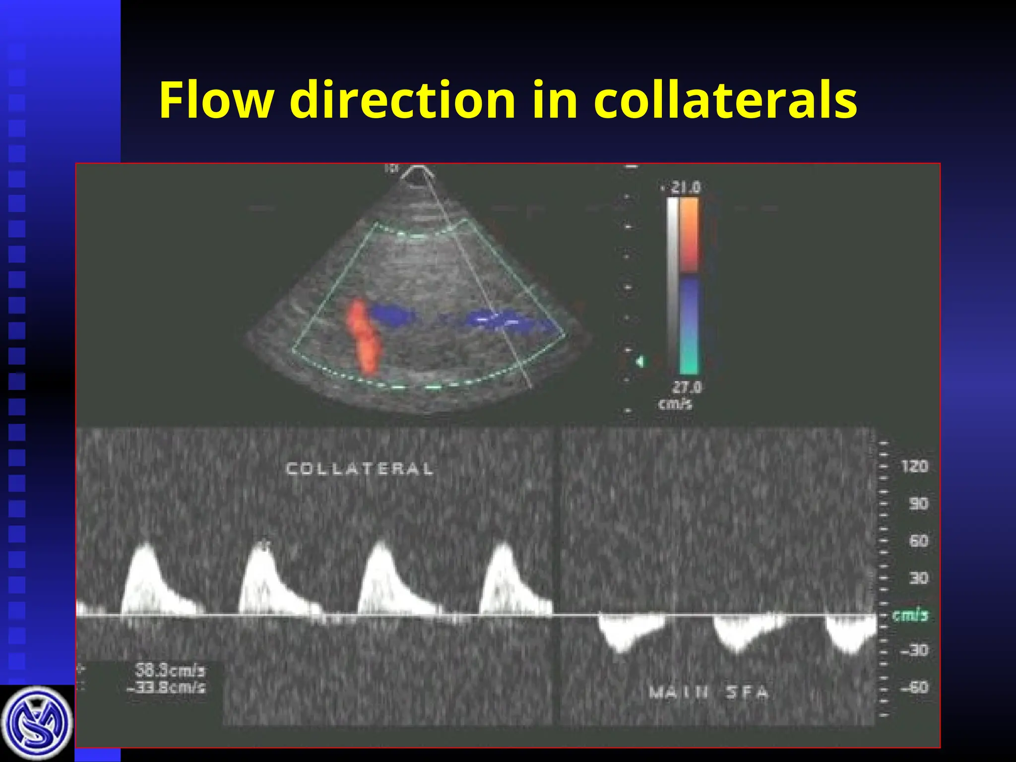 Flow direction in collaterals
 