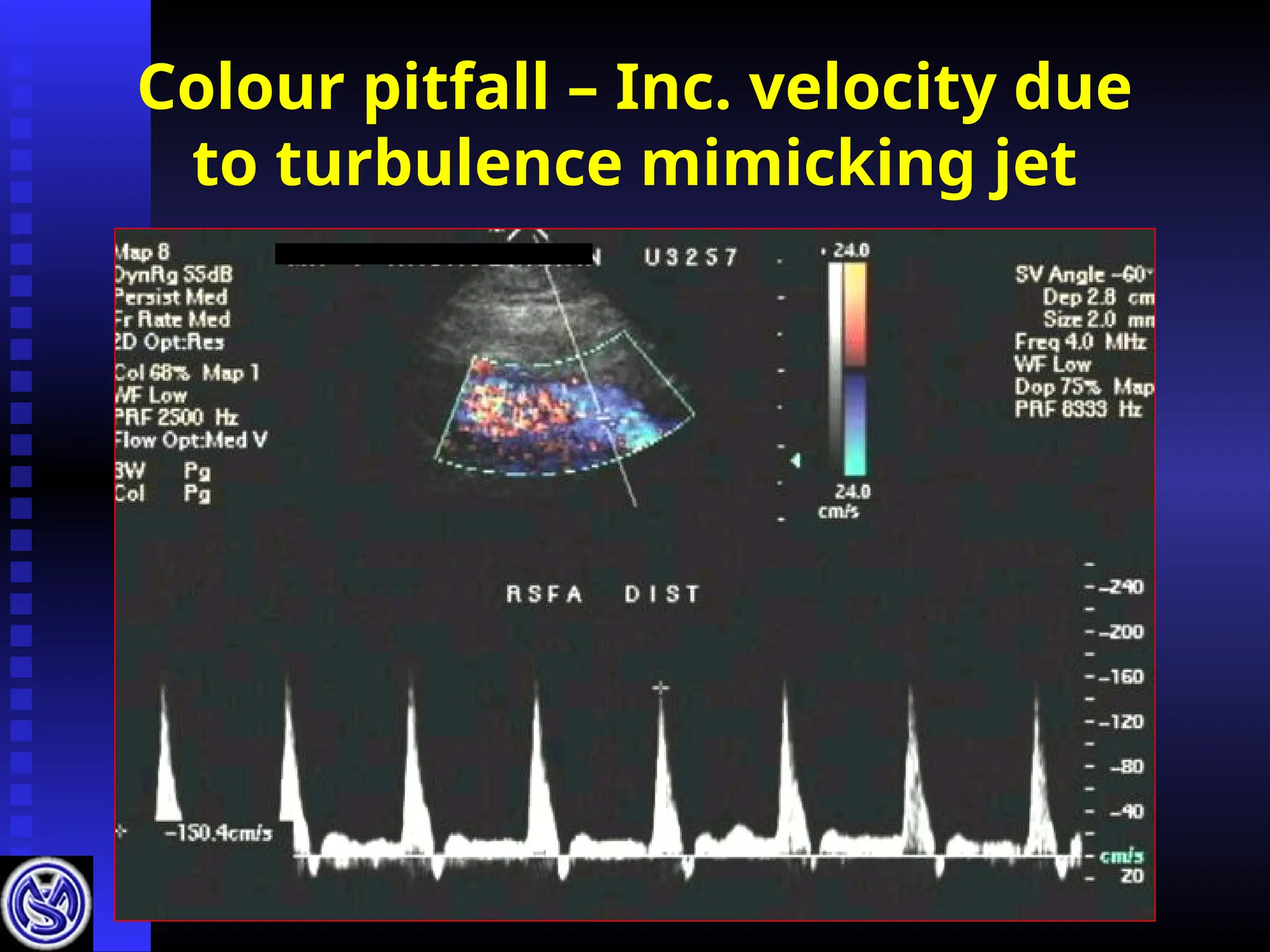 Colour pitfall – Inc. velocity due
to turbulence mimicking jet
 