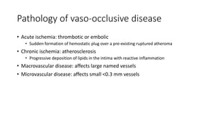 Pathology of vaso-occlusive disease
• Acute ischemia: thrombotic or embolic
• Sudden formation of hemostatic plug over a pre-existing ruptured atheroma
• Chronic ischemia: atherosclerosis
• Progressive deposition of lipids in the intima with reactive inflammation
• Macrovascular disease: affects large named vessels
• Microvascular disease: affects small <0.3 mm vessels
 