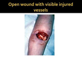 Arterial injury