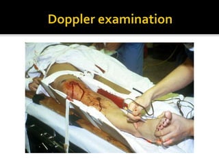 Arterial injury