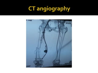 Arterial injury