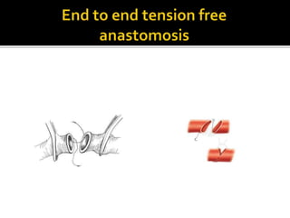 Arterial injury