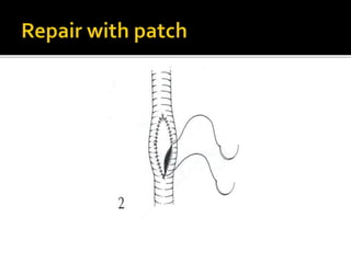 Arterial injury