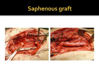 Arterial injury