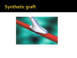 Arterial injury