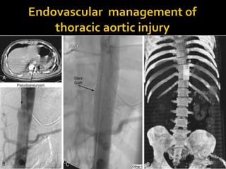 Arterial injury
