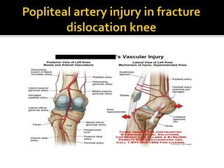 Arterial injury