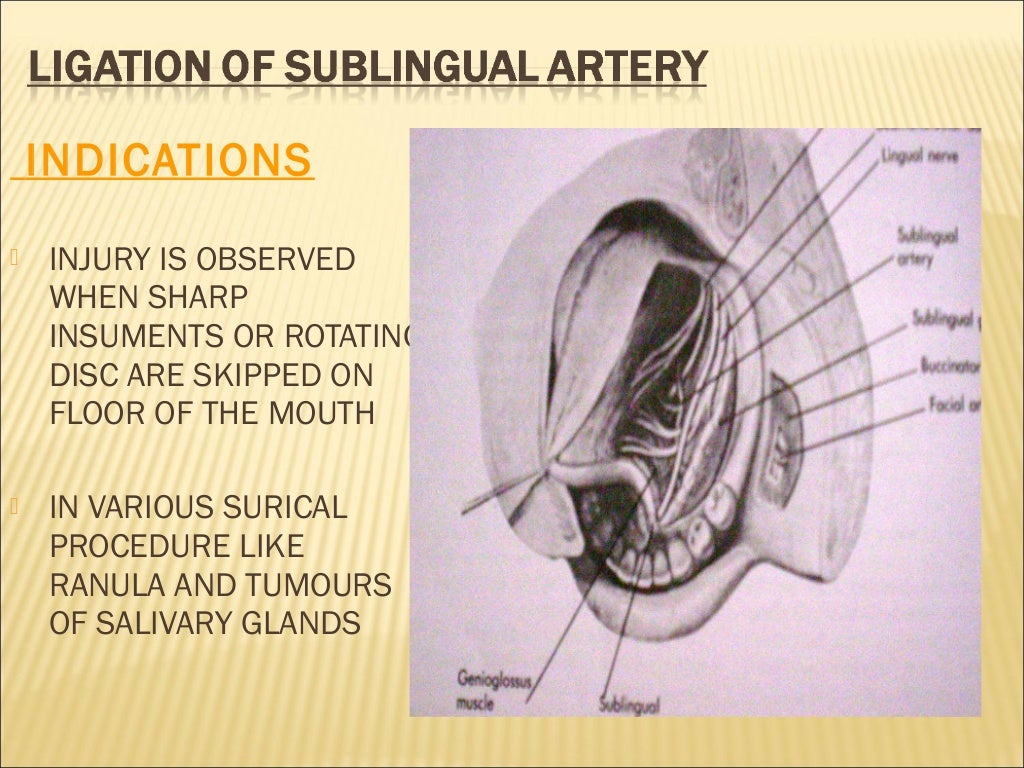 VESSEL ligation