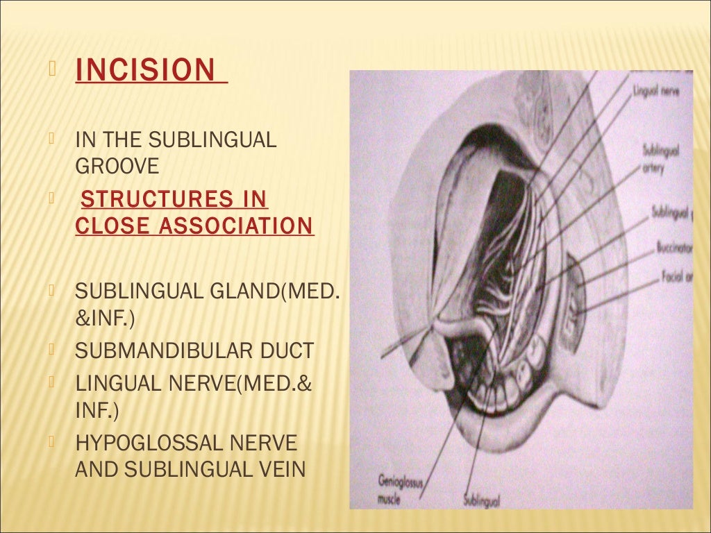 VESSEL ligation