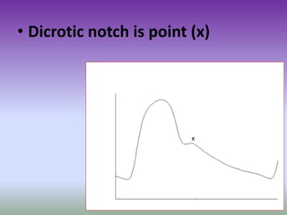 • Dicrotic notch is point (x)
x
 