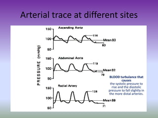 Arterial trace at different sites
BLOOD turbulance that
causes
the systolic pressure to
rise and the diastolic
pressure to fall slightly in
the more distal arteries.
 