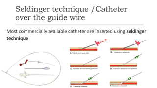 Seldinger technique /Catheter
over the guide wire
Most commercially available catheter are inserted using seldinger
technique
 
