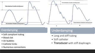Overdamping
• Soft compliant tubing
• Blood clot
• Air bubbles
• Catheter kinks
• Numerous connections
Underdamping
• Long and stiff tubing
• Stiff catheter
• Transducer with stiff diaphragm
 