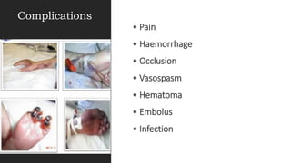Complications
• Pain
• Haemorrhage
• Occlusion
• Vasospasm
• Hematoma
• Embolus
• Infection
 