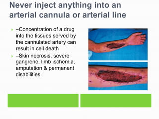    –Concentration of a drug
    into the tissues served by
    the cannulated artery can
    result in cell death
   –Skin necrosis, severe
    gangrene, limb ischemia,
    amputation & permanent
    disabilities
 