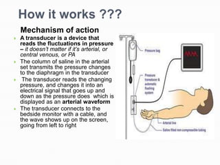 Mechanism of action
   A transducer is a device that
    reads the fluctuations in pressure
    – it doesn’t matter if it’s arterial, or
    central venous, or PA
   The column of saline in the arterial
    set transmits the pressure changes
    to the diaphragm in the transducer
    The transducer reads the changing
    pressure, and changes it into an
    electrical signal that goes up and
    down as the pressure does which is
    displayed as an arterial waveform
   The transducer connects to the
    bedside monitor with a cable, and
    the wave shows up on the screen,
    going from left to right
 
