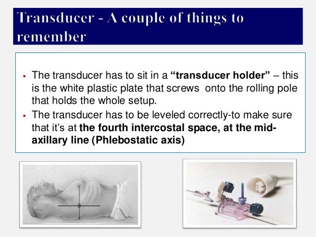 Arterial lines by Dr.Tinku Joseph