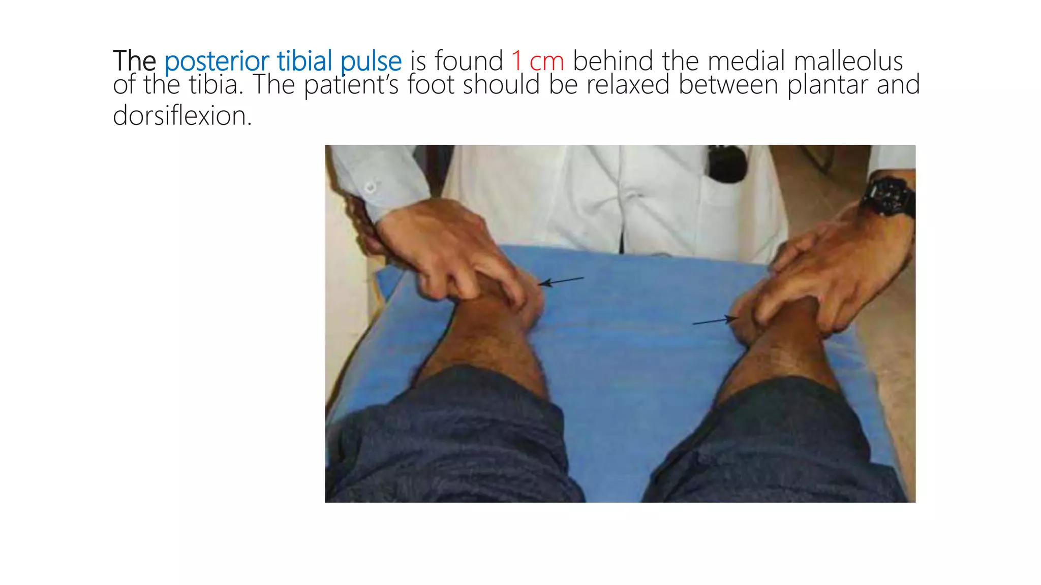 The posterior tibial pulse is found 1 cm behind the medial malleolus
of the tibia. The patient’s foot should be relaxed between plantar and
dorsiflexion.
 