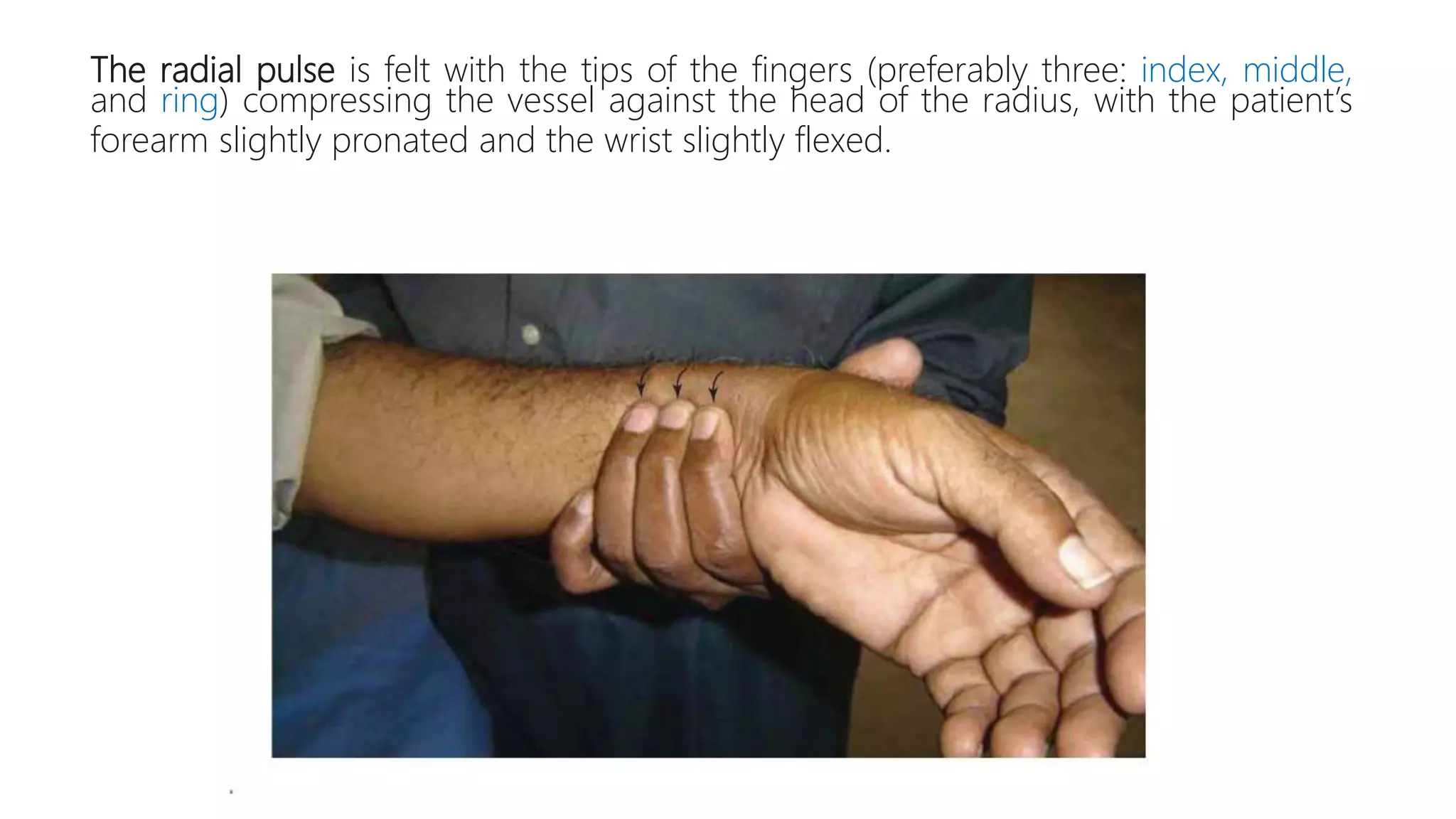 The radial pulse is felt with the tips of the fingers (preferably three: index, middle,
and ring) compressing the vessel against the head of the radius, with the patient’s
forearm slightly pronated and the wrist slightly flexed.
 