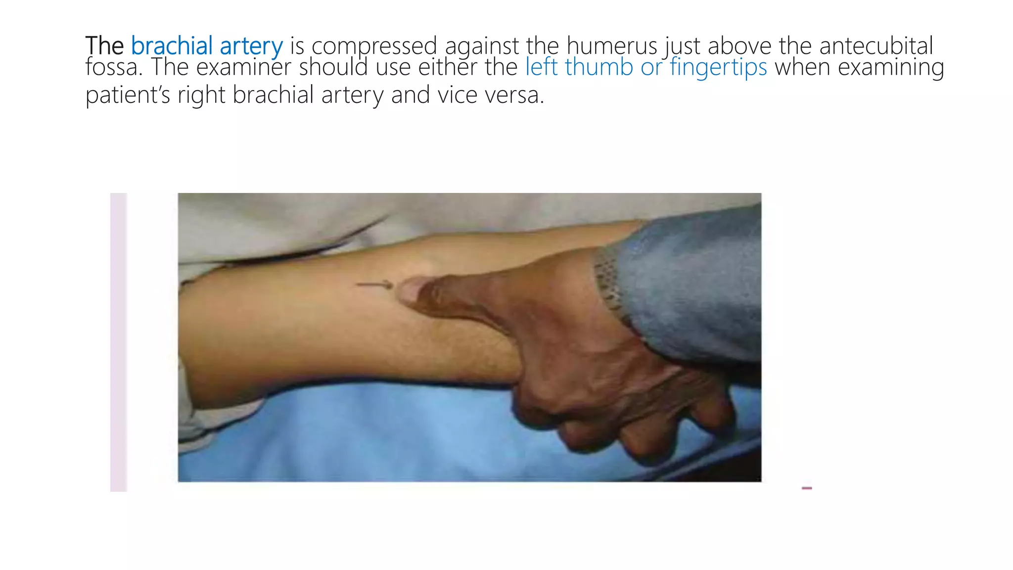 The brachial artery is compressed against the humerus just above the antecubital
fossa. The examiner should use either the left thumb or fingertips when examining
patient’s right brachial artery and vice versa.
 