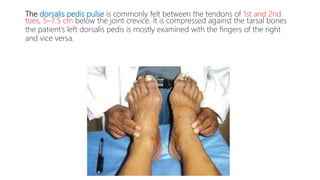The dorsalis pedis pulse is commonly felt between the tendons of 1st and 2nd
toes, 5–7.5 cm below the joint crevice. It is compressed against the tarsal bones
the patient’s left dorsalis pedis is mostly examined with the fingers of the right
and vice versa.
 