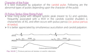 Character of the Pulse
It is best evaluated by palpation of the carotid pulse. Following are the
abnormal types of pulses depending upon the character of the pulse:
(1) Pulsus Tardus (Slow Rising Pulse)
 Slow rising pulse with delayed systolic peak (nearer to S2) and upstroke,
frequently associated with a thrill in the carotids (carotid shudder) is
characteristic of AS, and often occurs with pulsus parvus (i.e. pulsus parvus
et tardus).
 It is better appreciated by simultaneous auscultation and carotid palpation.
 