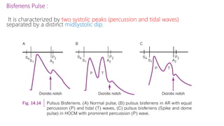Bisferiens Pulse :
It is characterized by two systolic peaks (percussion and tidal waves)
separated by a distinct midsystolic dip.
 