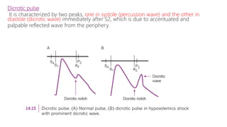 Dicrotic pulse
It is characterized by two peaks, one in systole (percussion wave) and the other in
diastole (dicrotic wave) immediately after S2, which is due to accentuated and
palpable reflected wave from the periphery.
 