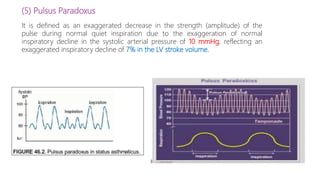 (5) Pulsus Paradoxus
It is defined as an exaggerated decrease in the strength (amplitude) of the
pulse during normal quiet inspiration due to the exaggeration of normal
inspiratory decline in the systolic arterial pressure of 10 mmHg, reflecting an
exaggerated inspiratory decline of 7% in the LV stroke volume.
 