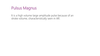 Pulsus Magnus
It is a high volume large amplitude pulse because of an
stroke volume, characteristically seen in AR.
 