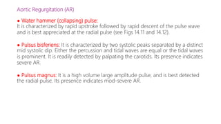 Aortic Regurgitation (AR)
● Water hammer (collapsing) pulse:
It is characterized by rapid upstroke followed by rapid descent of the pulse wave
and is best appreciated at the radial pulse (see Figs 14.11 and 14.12).
● Pulsus bisferiens: It is characterized by two systolic peaks separated by a distinct
mid systolic dip. Either the percussion and tidal waves are equal or the tidal waves
is prominent. It is readily detected by palpating the carotids. Its presence indicates
severe AR.
● Pulsus magnus: It is a high volume large amplitude pulse, and is best detected
the radial pulse. Its presence indicates mod-severe AR.
 