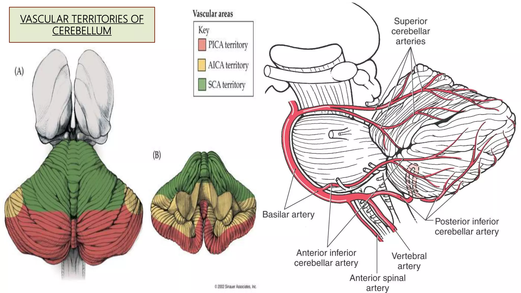 RADIOLOGICAL ANATOMY OF ARTERIAL SUPPLY OF BRAIN | PPTX