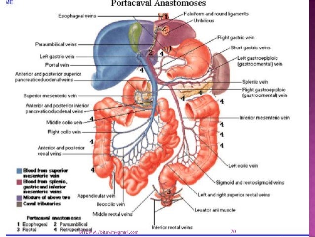 Arterial supply of the abdomen aorta.ppt
