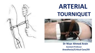 ARTERIAL
TOURNIQUET
Dr Nisar Ahmed Arain
Assistant Professor
Anesthesia/Critical Care/ER
 