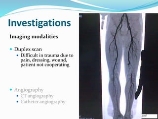 Investigations
Imaging modalities
 Duplex scan
 Difficult in trauma due to
pain, dressing, wound,
patient not cooperating
 Angiography
 CT angiography
 Catheter angiography
 
