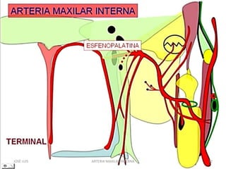 JOSÉ LUIS 12ARTERIA MAXILAR INTERNA
 