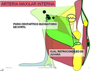 JOSÉ LUIS 4ARTERIA MAXILAR INTERNA
 