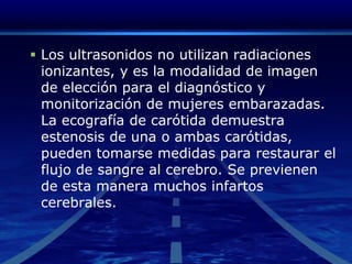 Los ultrasonidos no utilizan radiaciones ionizantes, y es la modalidad de imagen de elección para el diagnóstico y monitorización de mujeres embarazadas. La ecografía de carótida demuestra estenosis de una o ambas carótidas, pueden tomarse medidas para restaurar el flujo de sangre al cerebro. Se previenen de esta manera muchos infartos cerebrales. 