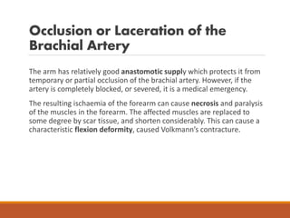 Occlusion or Laceration of the
Brachial Artery
The arm has relatively good anastomotic supply which protects it from
temporary or partial occlusion of the brachial artery. However, if the
artery is completely blocked, or severed, it is a medical emergency.
The resulting ischaemia of the forearm can cause necrosis and paralysis
of the muscles in the forearm. The affected muscles are replaced to
some degree by scar tissue, and shorten considerably. This can cause a
characteristic flexion deformity, caused Volkmann’s contracture.
 