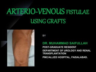 ARTERIO-VENOUS FISTULAE
USING GRAFTS
BY
DR. MUHAMMAD SAIFULLAH
POST-GRADUATE RESIDENT
DEPARTMENT OF UROLOGY AND RENAL
TRANSPLANTATION
PMC/ALLIED HOSPITAL, FAISALABAD.
 