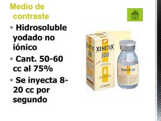 Medio de
 contraste
 Hidrosoluble
 yodado no
 iónico
 Cant. 50-60
 cc al 75%
 Se inyecta 8-
 20 cc por
 segundo
 