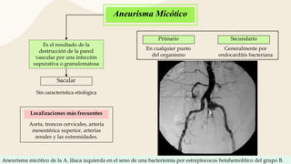 ARTERIOGRAFÍA Y FLEBOGRAFÍA.pptx