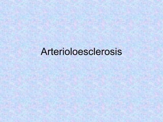 Arterioloesclerosis

 